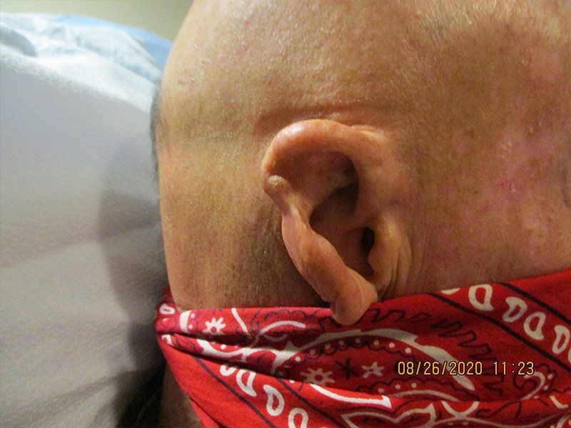 Right Ear
