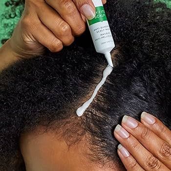 Itchy, Flaky Scalp