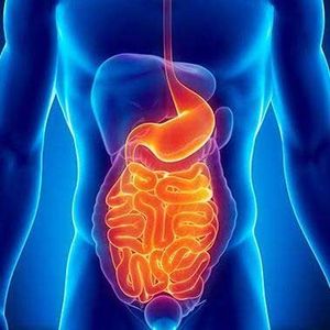 COLON IRRITABLE