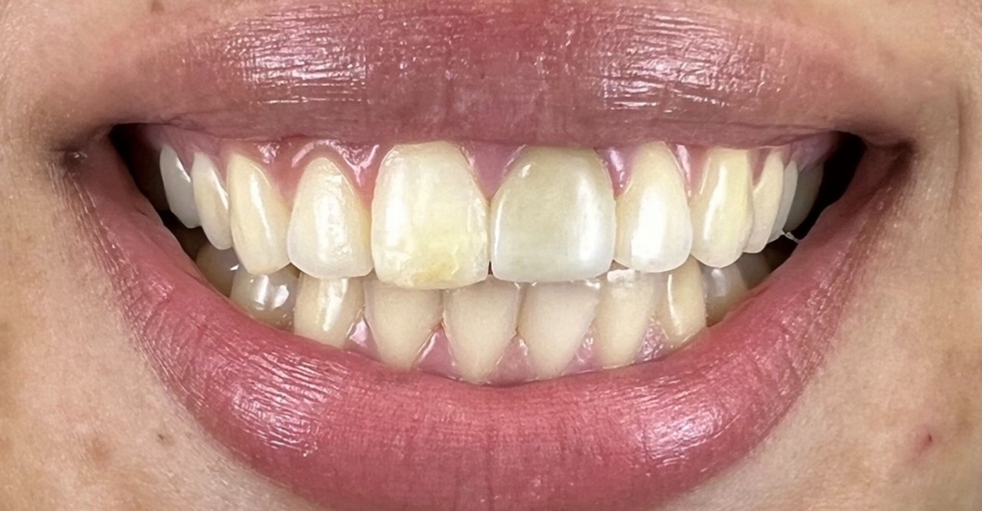 Luma Alouni, D.D.S. - Before and After