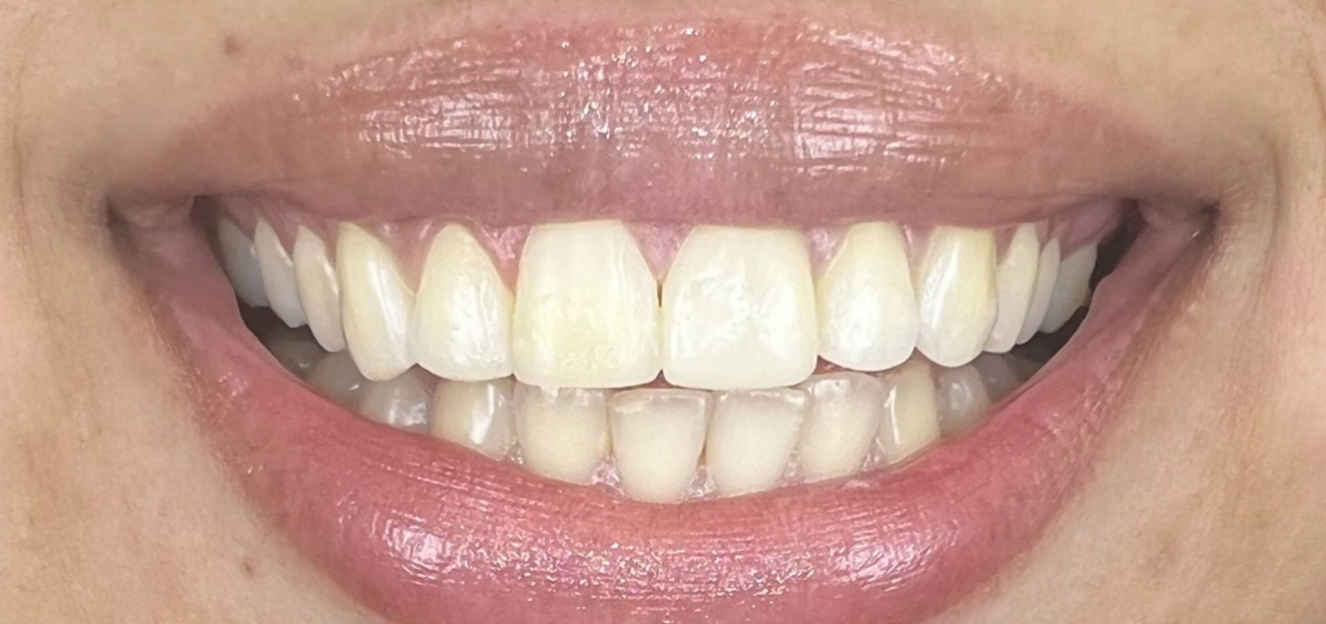 Luma Alouni, D.D.S. - Before and After