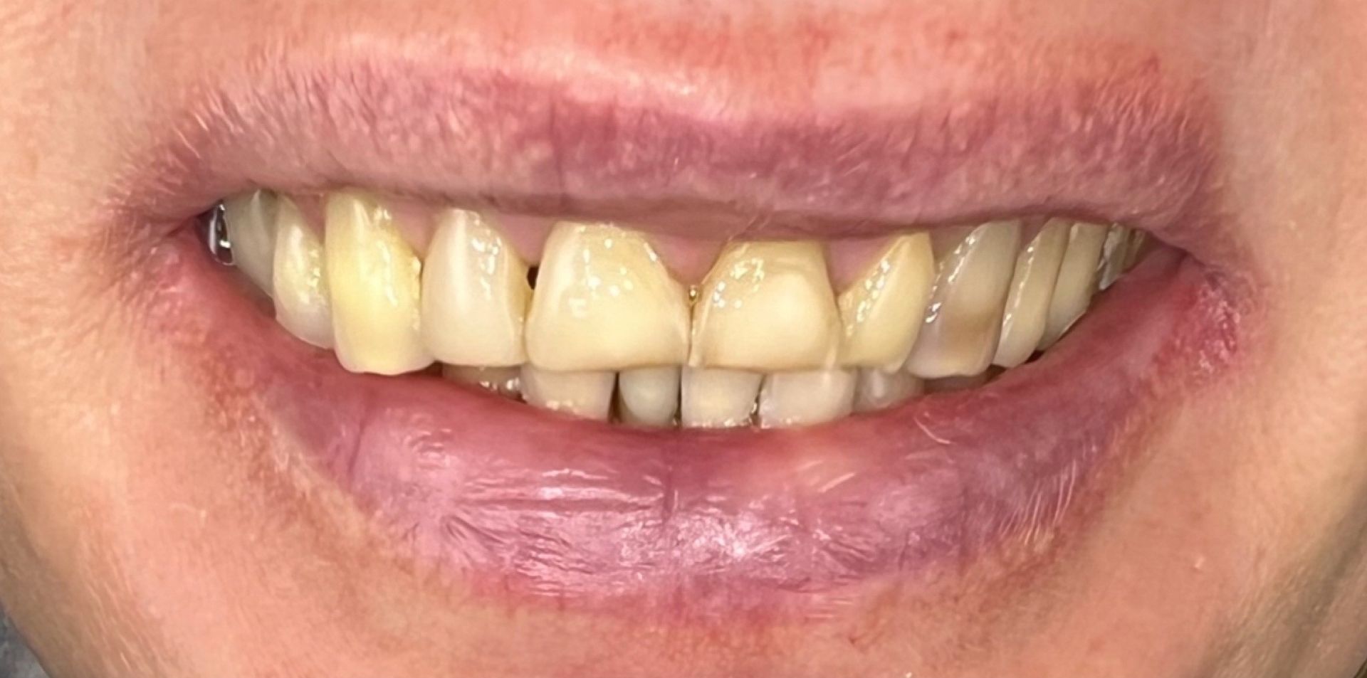Luma Alouni, D.D.S. - Before and After