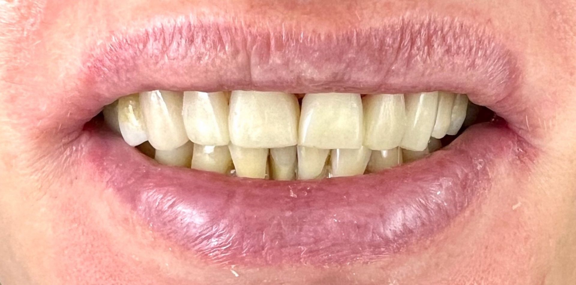 Luma Alouni, D.D.S. - Before and After