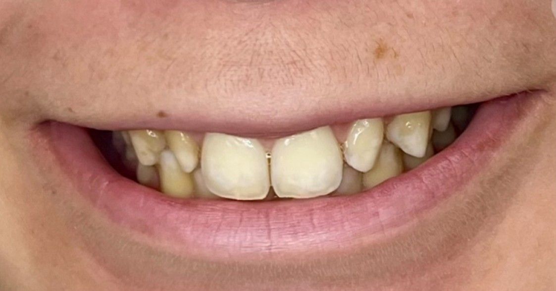 Luma Alouni, D.D.S. - Before and After