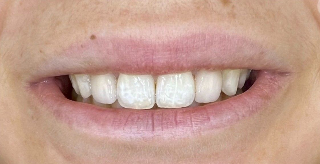 Luma Alouni, D.D.S. - Before and After