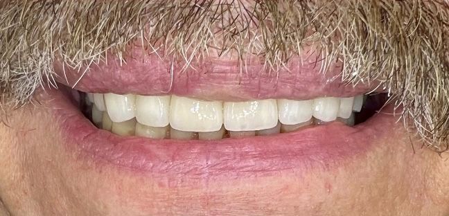 Luma Alouni, D.D.S. - Before and After