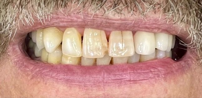 Luma Alouni, D.D.S. - Before and After