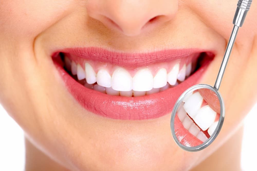 Close-up of a Smiling Person With Bright White Teeth