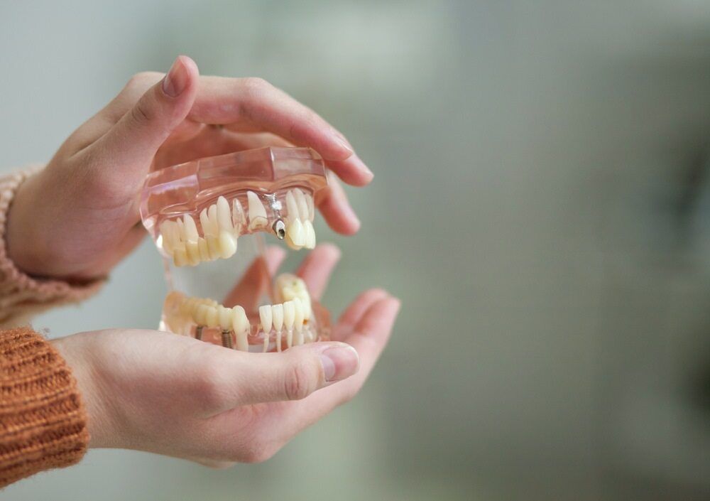A Person Is Holding A Model Of Teeth In Their Hands — St Ives Dental Boutique In Saint Ives, NSW