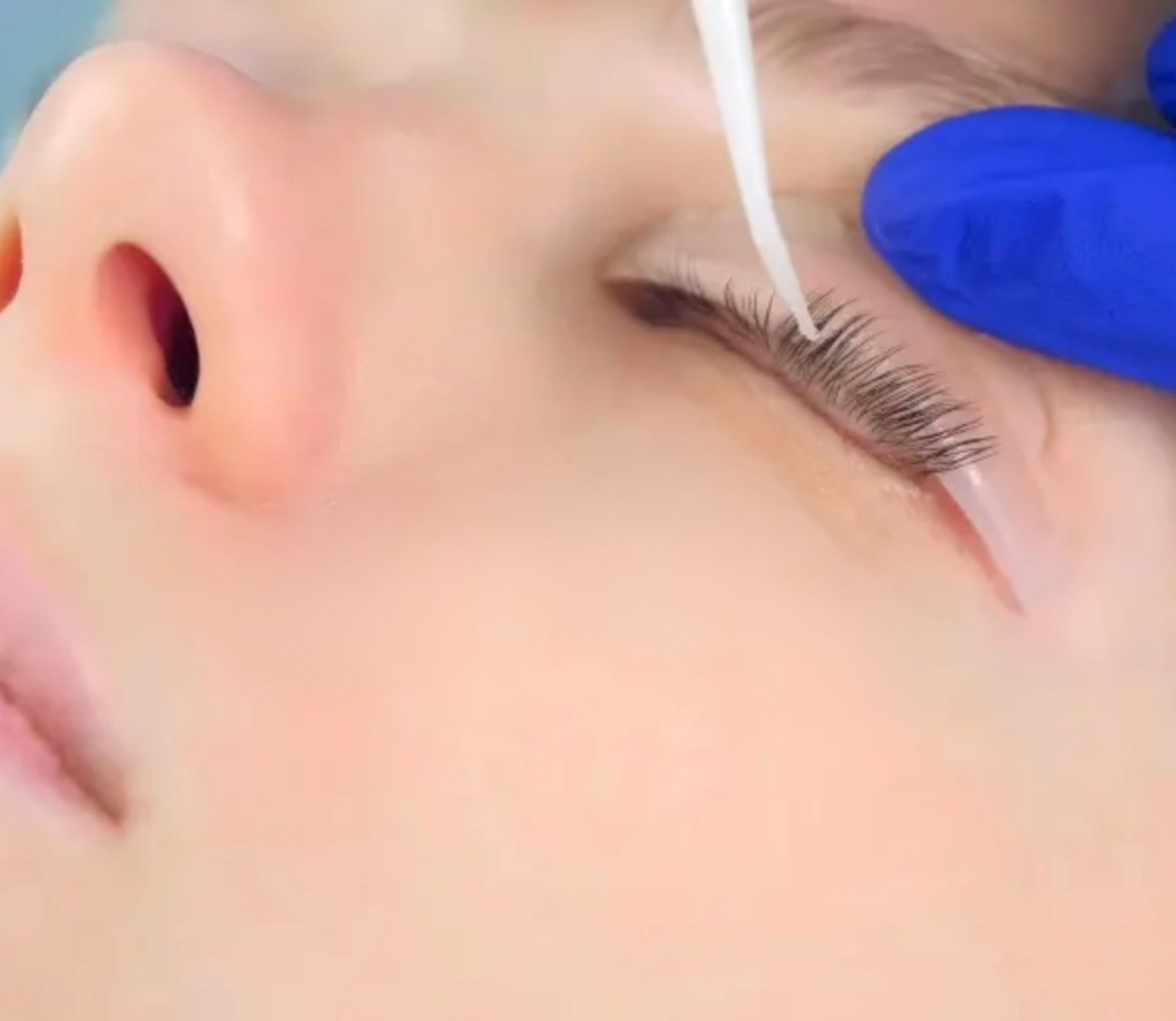 A close up of a person 's eye with a needle in it.