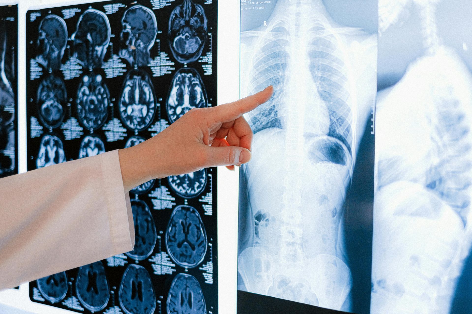 Rare Disease Imaging