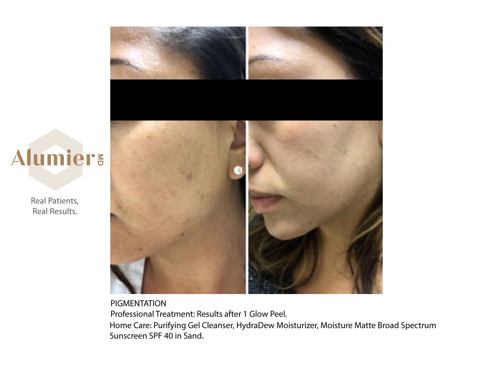 A before and after photo of a woman 's face.