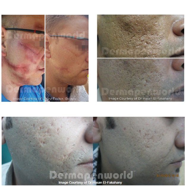 A before and after photo of a man 's face