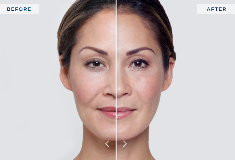 a before and after photo of a woman 's face