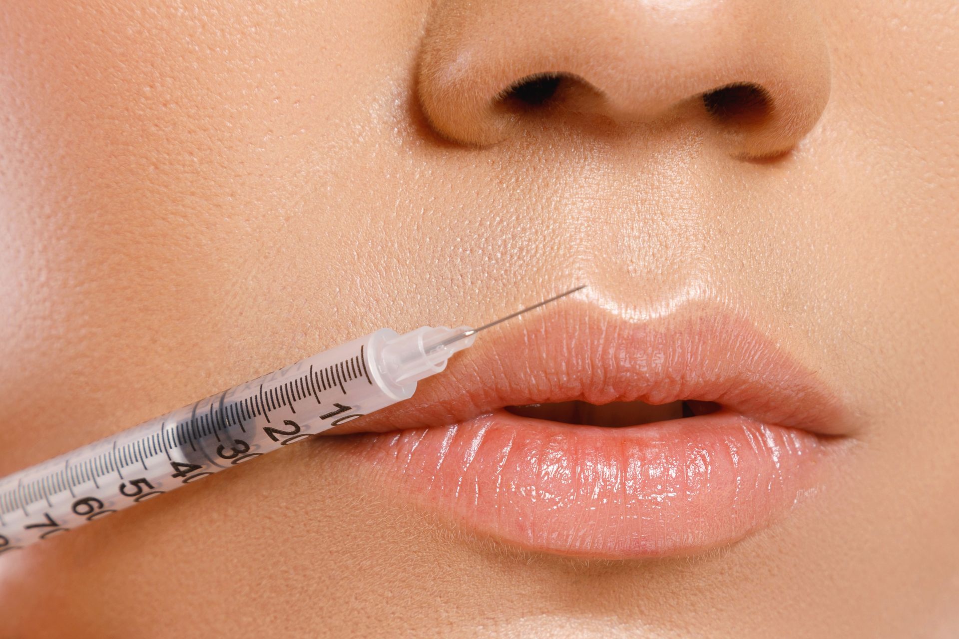 A woman is getting a botox injection in her lips.