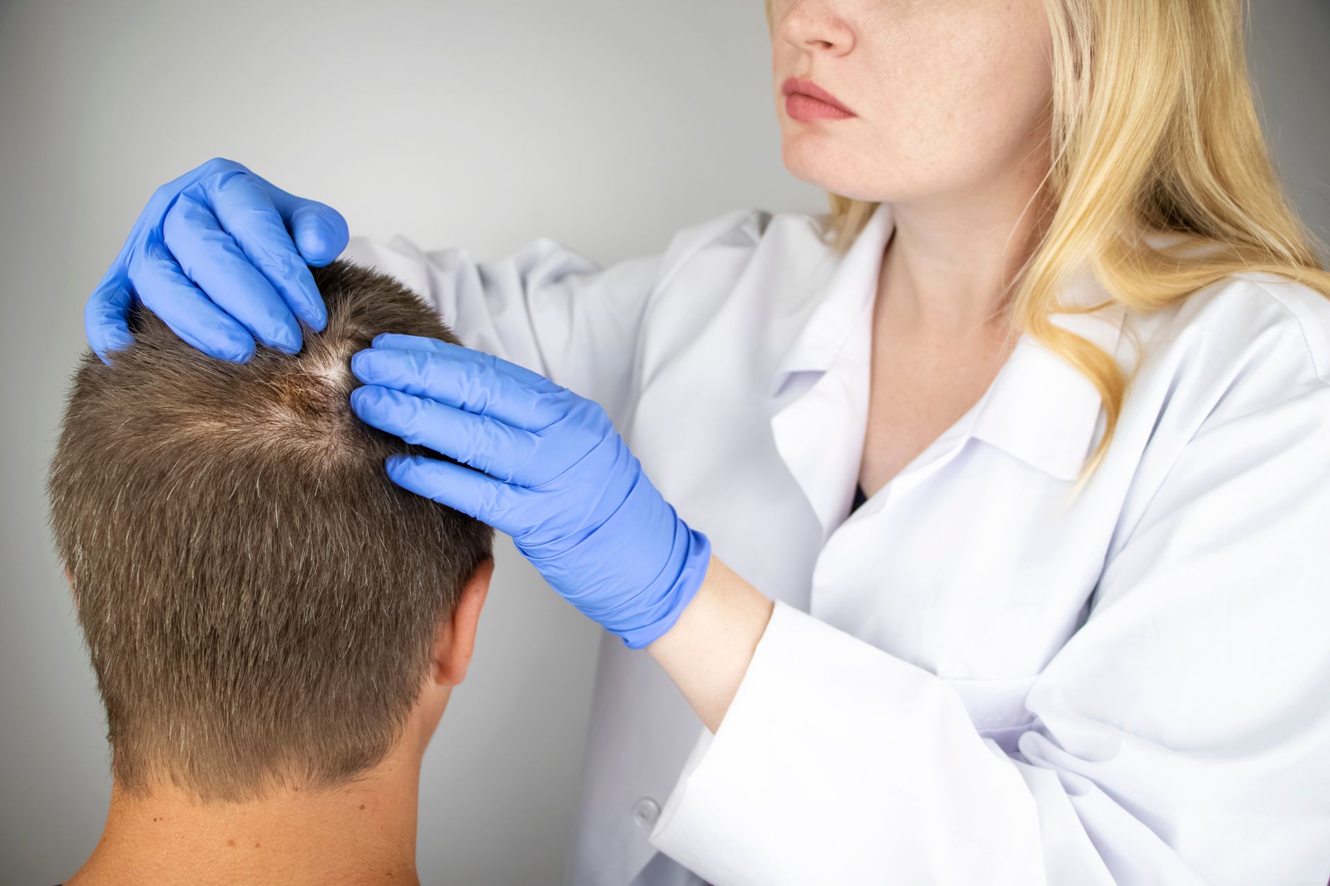 A woman is examining a man 's hair with blue gloves.
