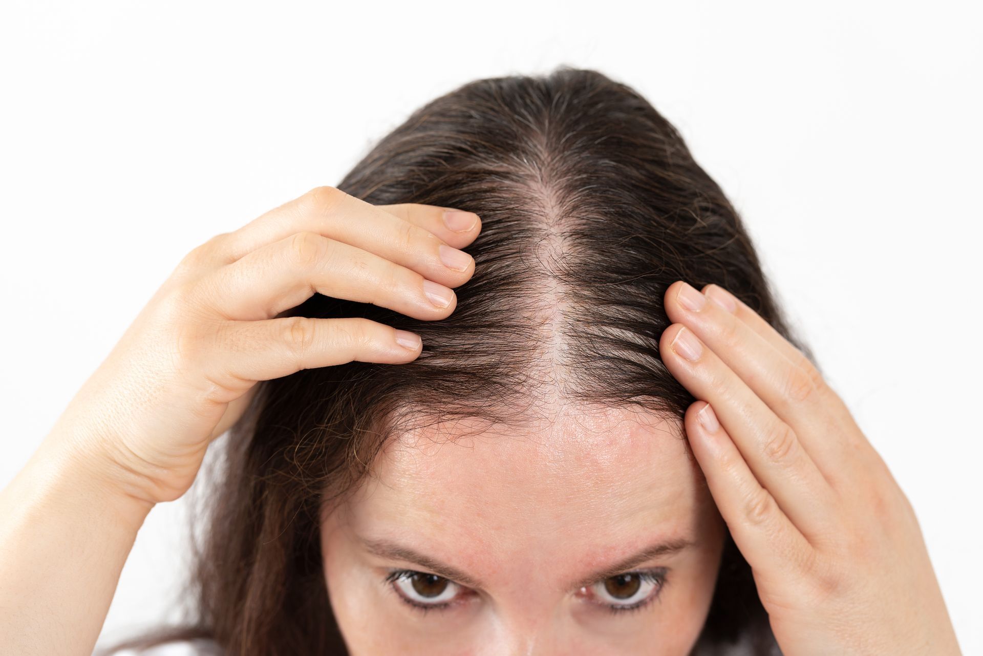 A person parts their dark hair with both hands to reveal a patch of dry, flaky, irritated skin on their scalp.
