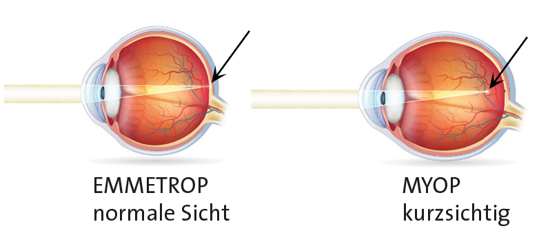 Lichteinfall Auge