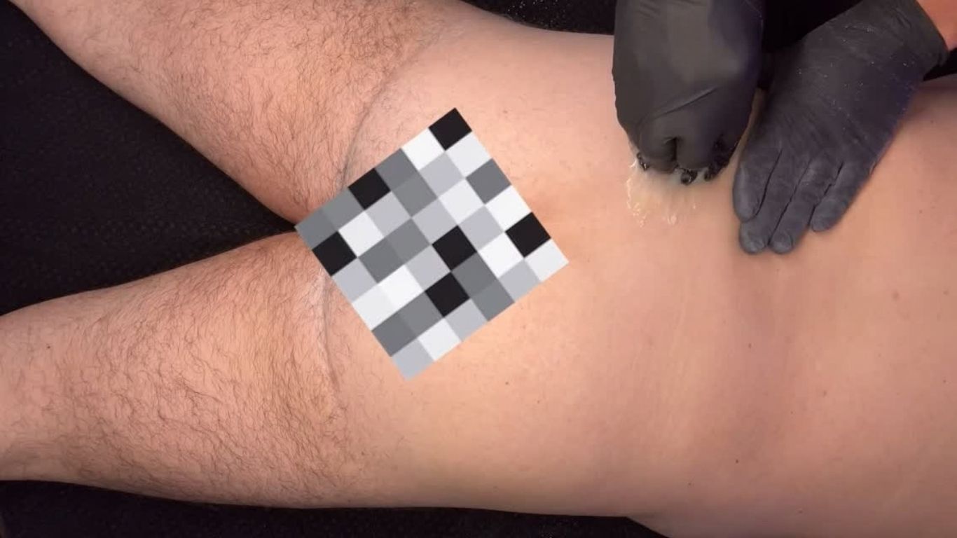 Gloved hand examining a bruised leg with a bandaged knee