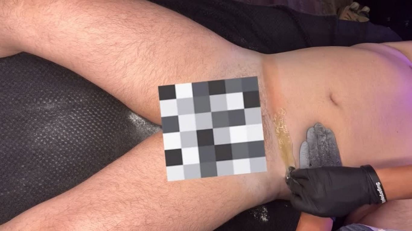 Close-up of a tattooed leg during a medical procedure, with a gloved hand and censored area