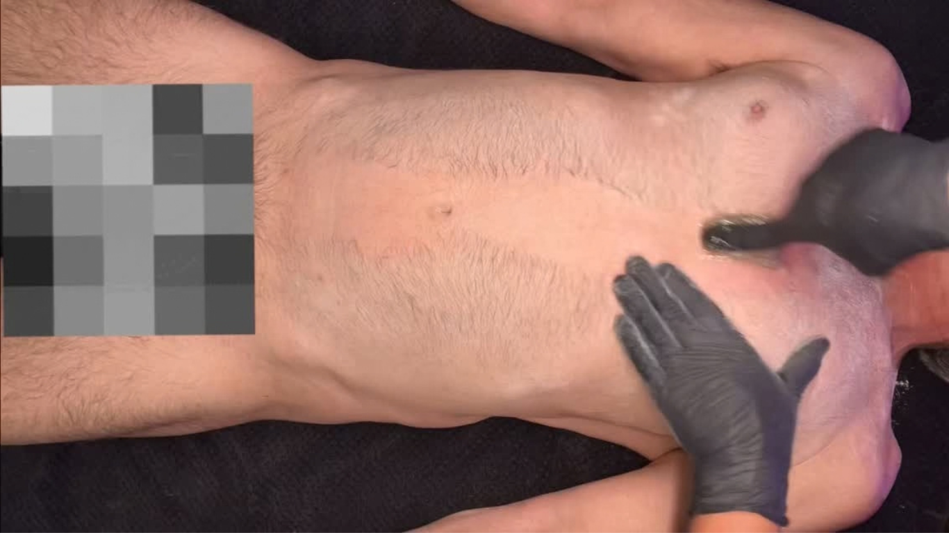Chest Facial