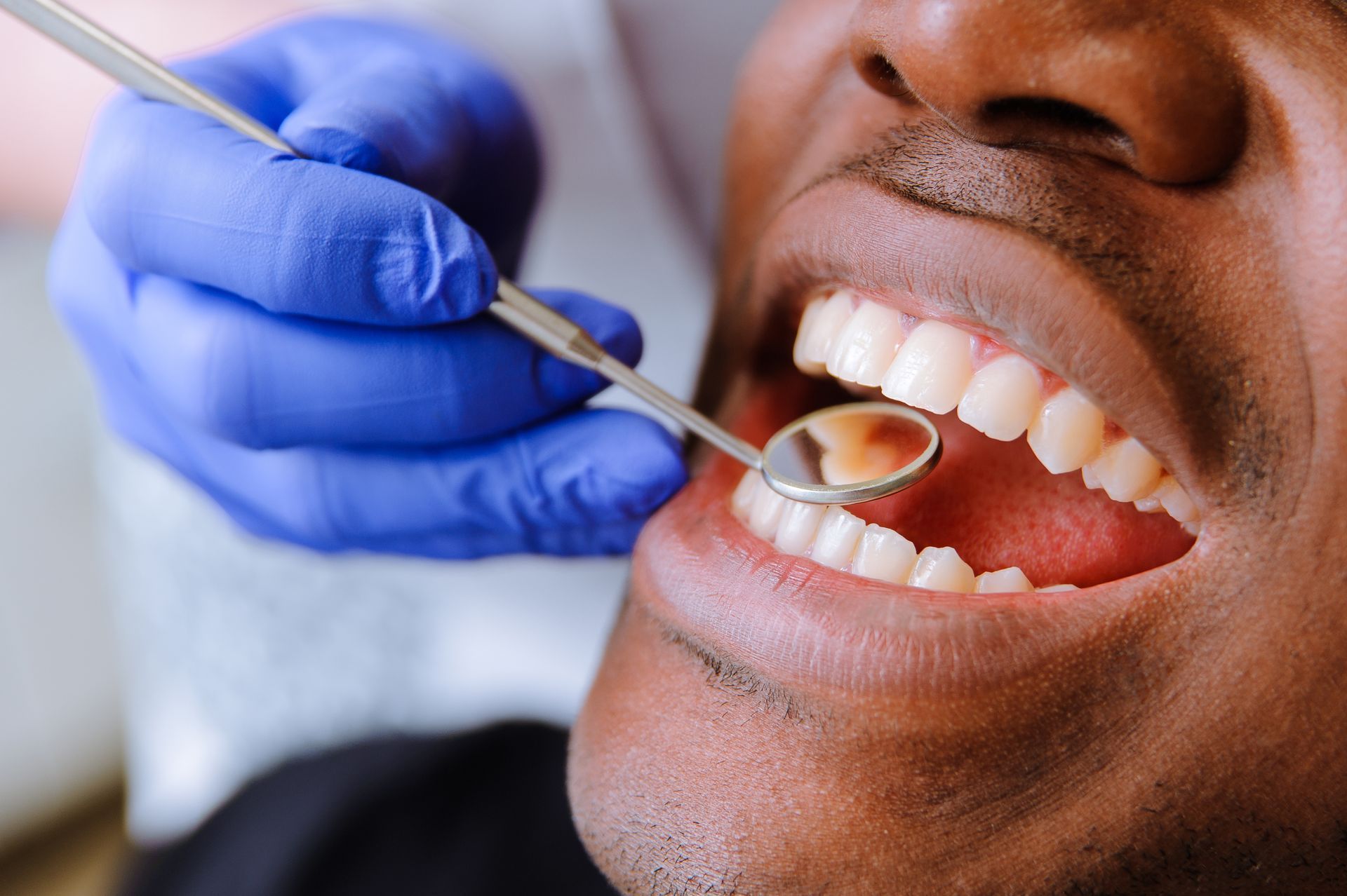 Dentist examining a patient’s open mouth with a dental mirror and blue gloves