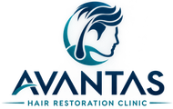 Hair Replacement Service in Alpharetta, GA | Avantas Hair Restoration Clinic Hair Replacement Service in Alpharetta, GA | Avantas Hair Restoration Clinic