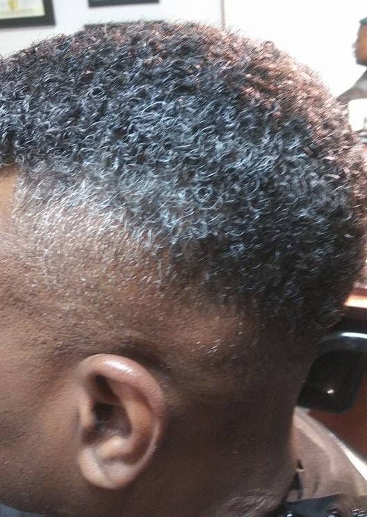 Hair Implant Consulting in Alpharetta, GA