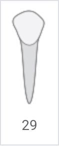 Gray tooth diagram labeled 29