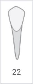 White elongated tooth diagram labeled 22