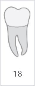 Tooth diagram labeled 18