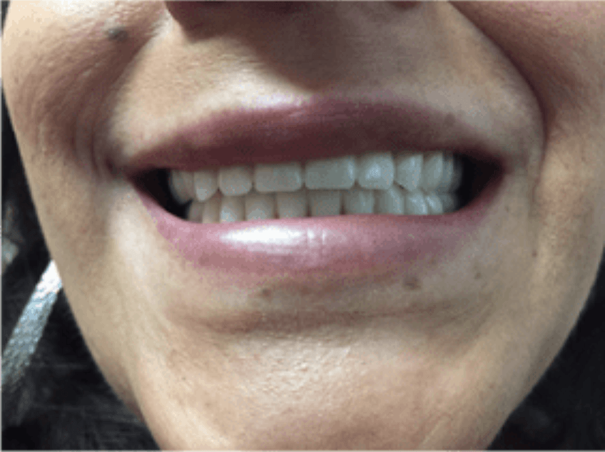 Close-up of a smiling mouth showing teeth and pink lips