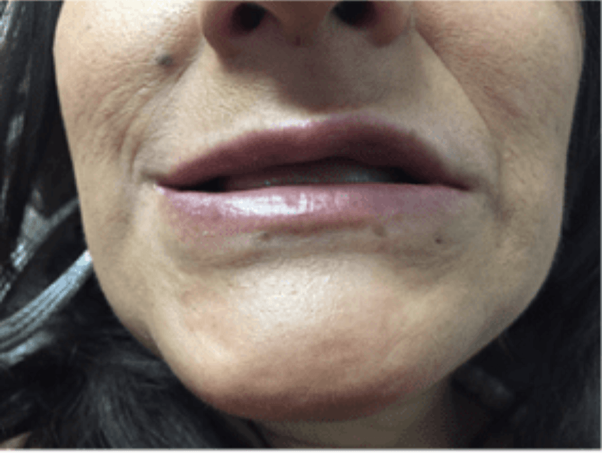 Close-up of a person’s mouth and chin with slightly parted lips and visible facial lines