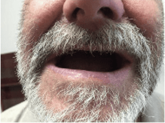 Close-up of a man’s mouth and gray beard with lips slightly open