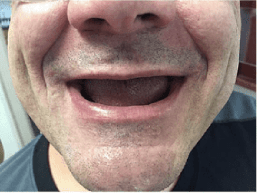 Close-up of a smiling mouth and lower face with light facial stubble