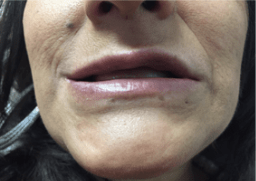 Close-up of a person’s lower face with slightly parted lips and visible wrinkles around the mouth