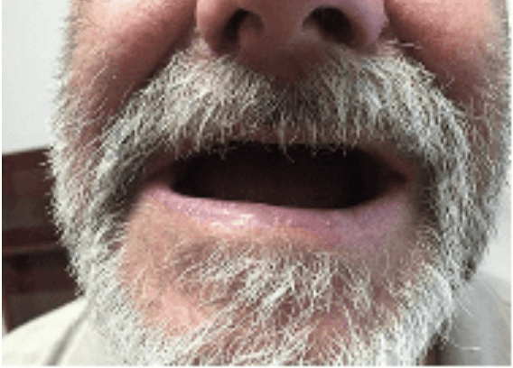 Close-up of a bearded person’s mouth and lower face, slightly open as if speaking