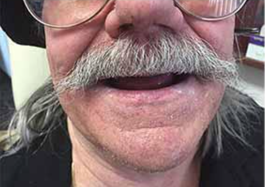 Close-up of a man’s mouth with a large gray mustache and glasses, smiling slightly
