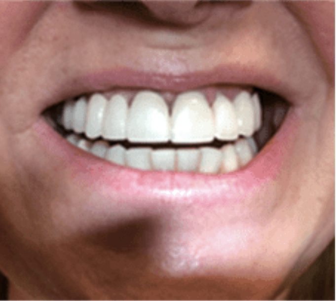 Close-up of a smiling mouth showing white teeth and pink lips