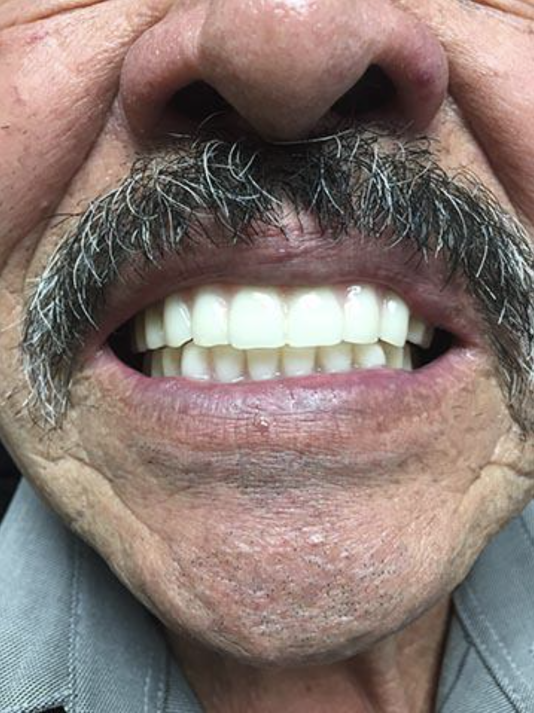 Close-up of a smiling mouth with a dark mustache and visible teeth.