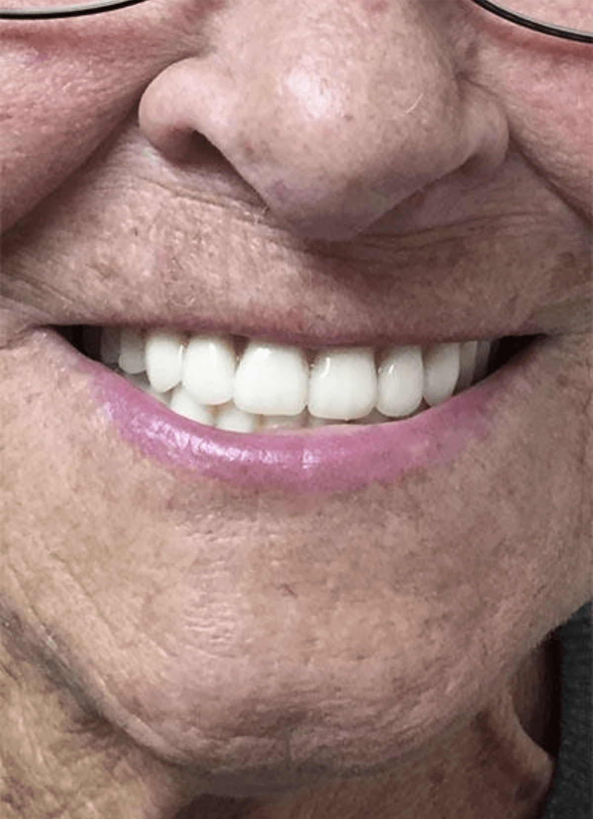 Close-up of a smiling mouth showing white teeth and pink lips