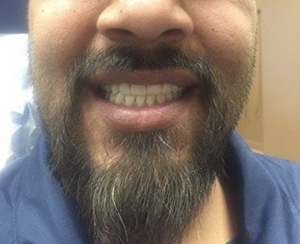 Close-up of a smiling man with a dark beard and mustache, showing his teeth.
