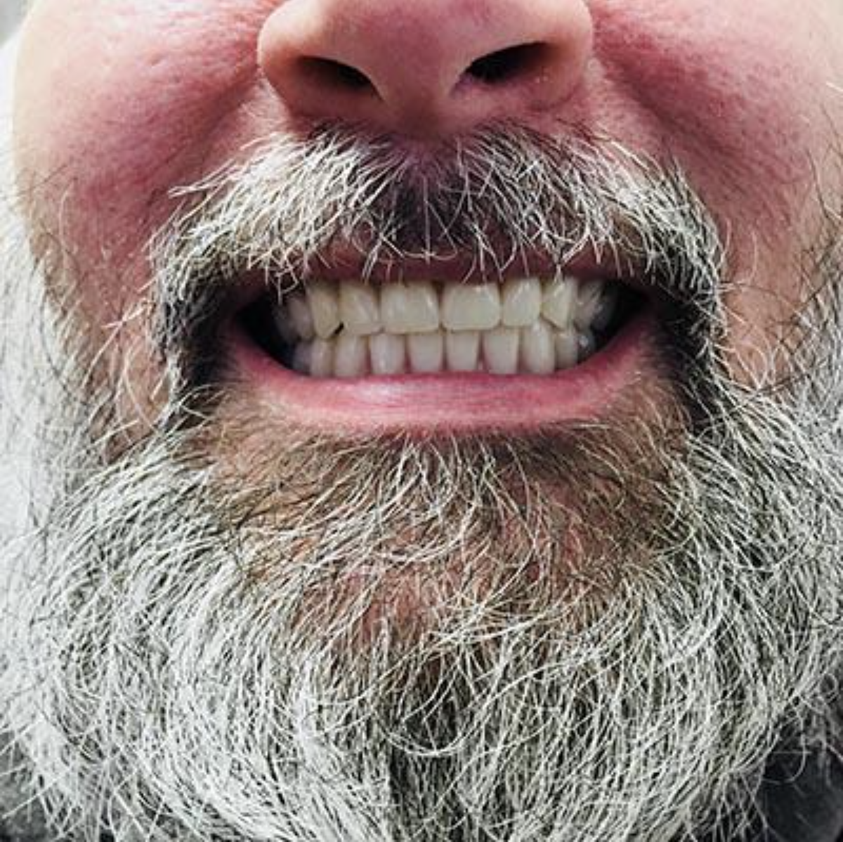 Close-up of a bearded mouth and nose, teeth clenched in a grimace.