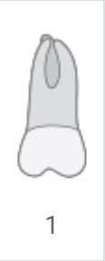 Simple black-and-white diagram of a tooth with a central groove, labeled “1” beneath it