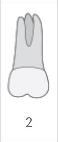 Gray tooth diagram labeled “2” underneath.
