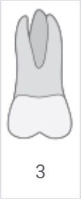 Gray tooth cross-section diagram labeled “3” with one root and a hollow center