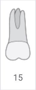 Gray tooth diagram labeled 15, showing a molar with two roots