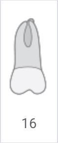 Gray tooth diagram labeled 16 with a highlighted upper center section