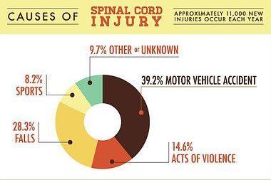 A pie chart showing the causes of spinal cord injury