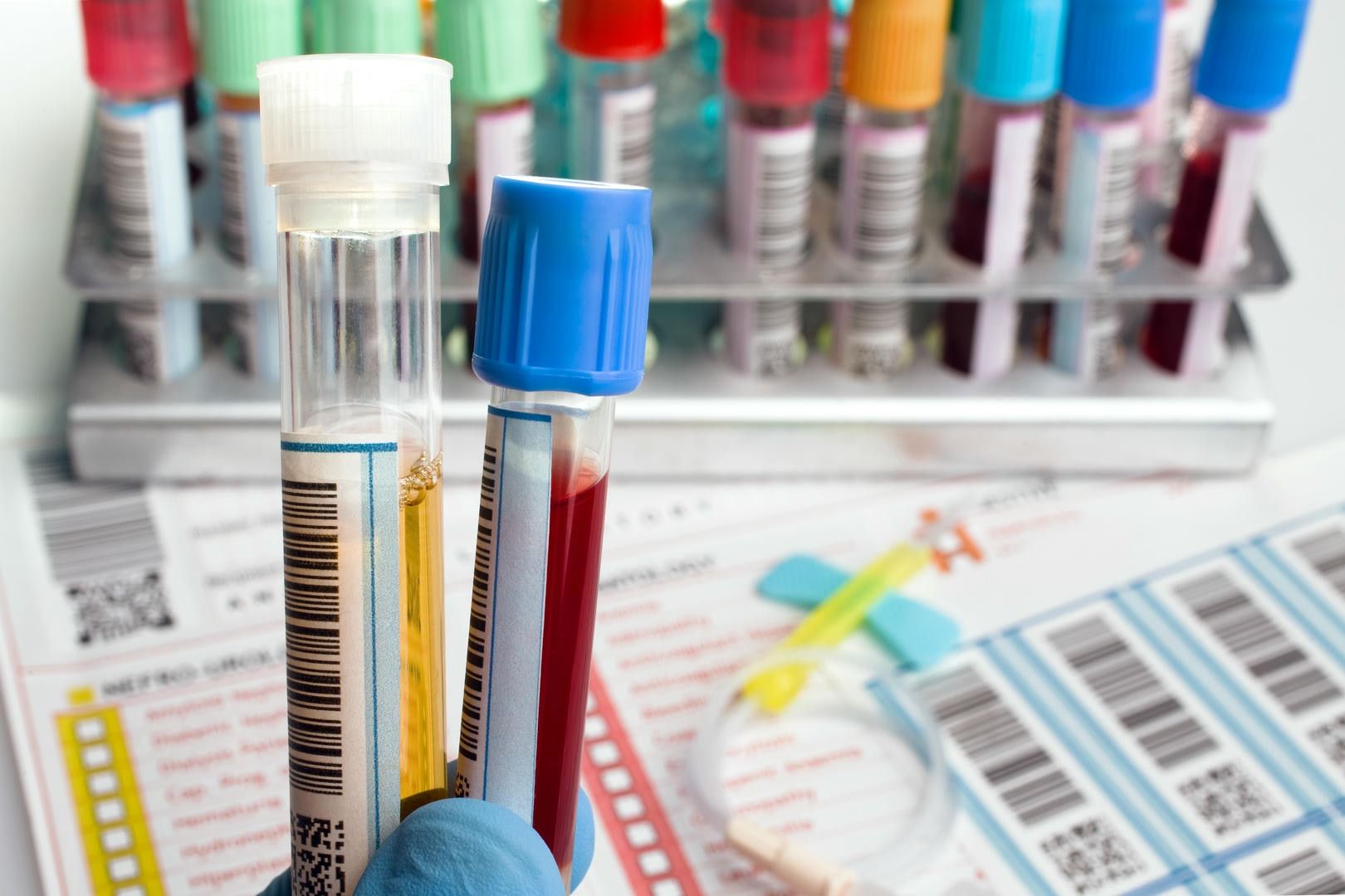 Blood samples in test tubes, rack and paperwork visible.